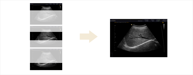 Az optimalis mélységek egyesítés - Full Spectrum Imaging képalkotás a műtermékmentes kép érdekében