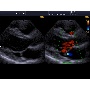 Cardiovascularis ultrahang - Accuvix A30